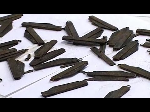 شاهد اخراج 40 موسًا من معدة رجل