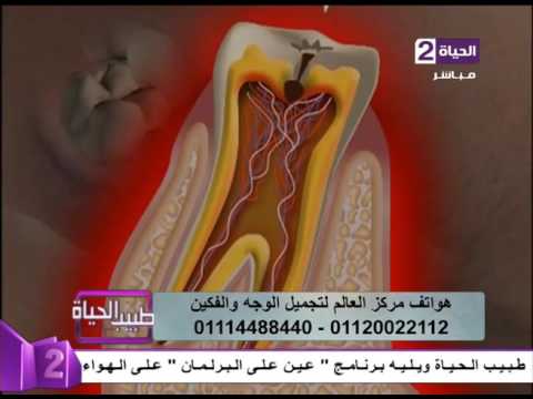 نصيحة لتجميل الأسنان عنالليزرلتجميل الأسنان