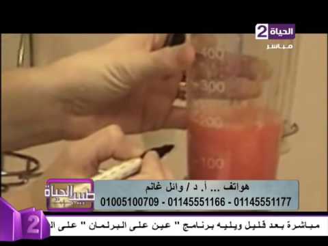 دكتور وائل غنيم يكشف كيفية شفط الدهون بالفيزر