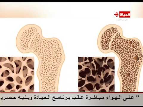 شرح تفصيلي بالصورللمفاصل بعد حدوث الإصابات بها
