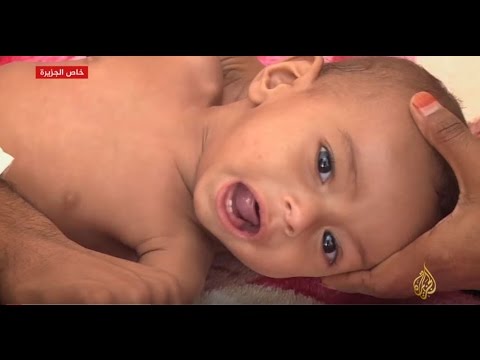 الوضع الإنساني في تعز يزداد سوءًا يومًا بعد يوم