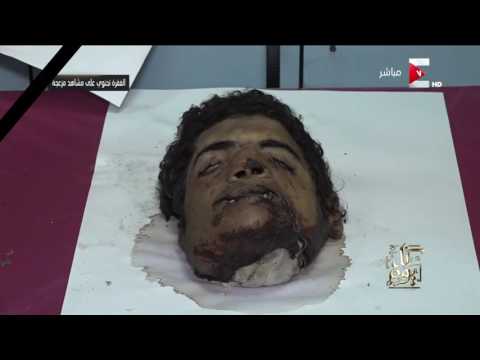 بالفيديو عمرو أديب يعرض صورًا لرأس منفّذ تفجير الكاتدرائية