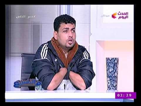 لص يقطع يديه ويناشد السيسي بتولّي أمره