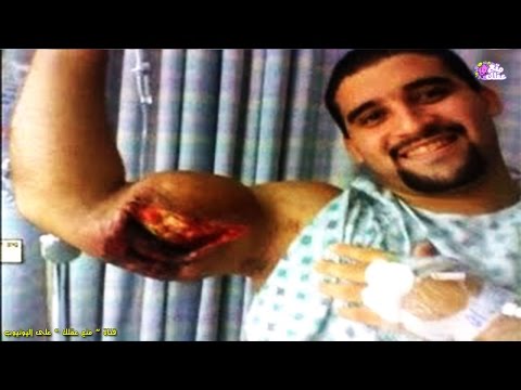 شاهد لاعبو كمال أجسام أنفجرت عضلاتهم