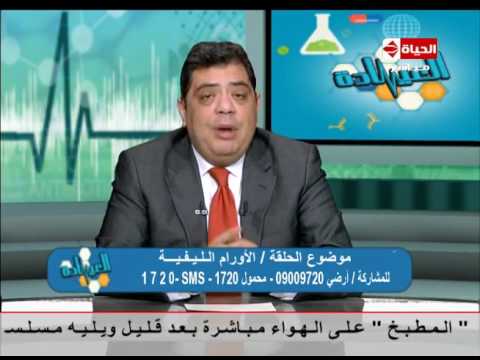 شاهد كيفية تشخيص الأورام الليفية عند النساء