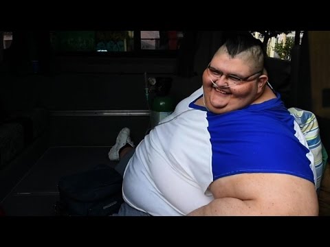 مكسيكي يستعد لإجراء عملية جراحية لإنقاذ وزنه