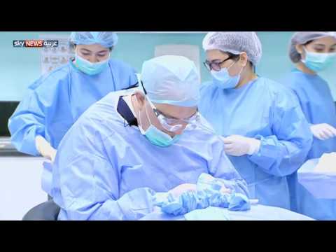 الخلايا الجذعية تدخل عالم زراعة الشعر
