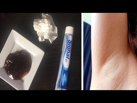 التخلص من شعر الجسم بدون ألم نهائيًا