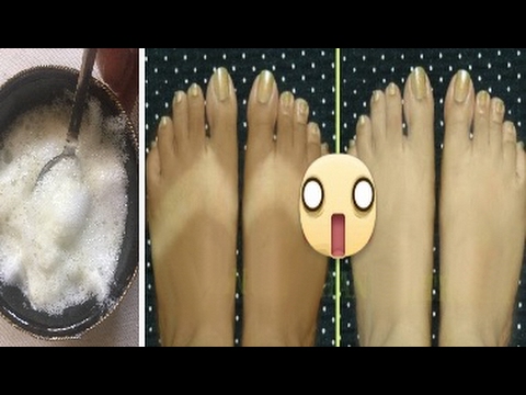 وصفة للتخلص من الأماكن الداكنة في الجسم