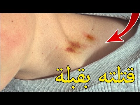 شاهد قبلة قوية على رقبة مراهق أدّت إلى مقتله