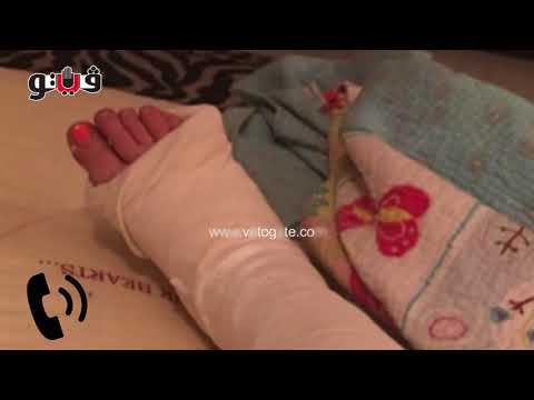شاهد ضحية بلطجة التجمع يؤكّد أنّه لن يقبل التصالح مع المعتدي عليه