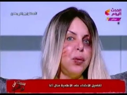 شاهد الإعلامية منال أغا تظهر على الهواء مباشرة وعلامات الضرب على وجهها