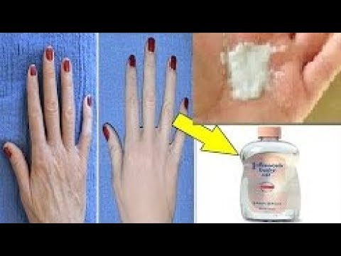 شاهد طريقة مجنونة لعلاج تجاعيد اليدين واسمرارها