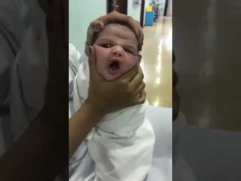ممرضات سعوديات يعبثن برأس طفل مولود