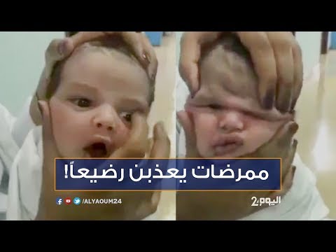ممرضات يعذبن رضيعًا في مستشفى سعودية