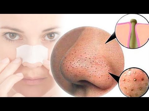 نتائج مذهلة لوضع معجون الأسنان على الأنف