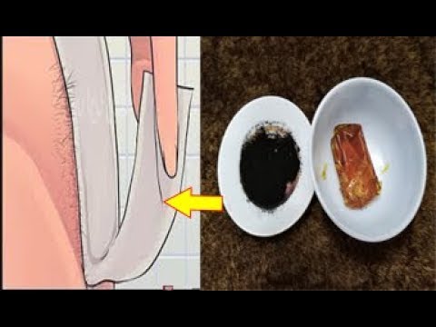 تخلصي من شعر العانة و الإبطين دون ألم نهائيًا