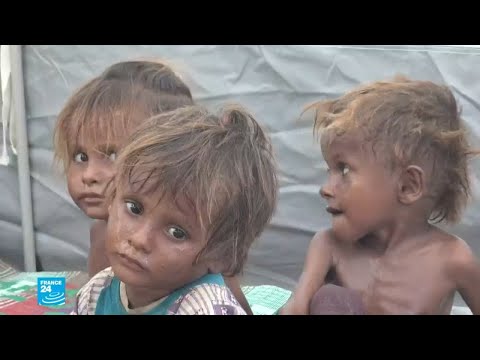 ظروف إنسانية مزرية وصور صادمة للنازحين من ويلات الحرب في اليمن