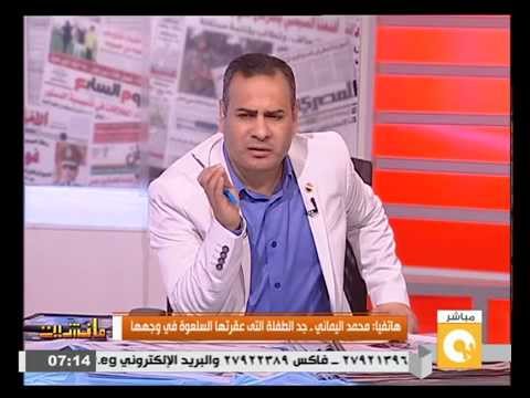 شاهد السلعوة تنهش وجه طفلة في القاهرة الجديدة