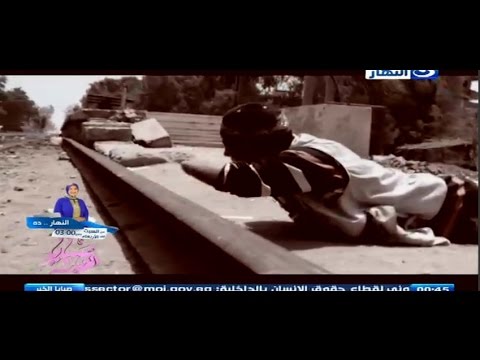 لص يعاقب نفسه بقطع يدية