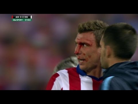 شاهد الدماء تسيل من وجه ماندزوكيتش