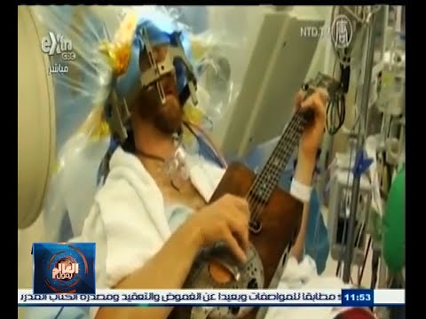 بالفيديو مريض يعزف بجيتاره أثناء خضوعة لعملية جراحية في المخ