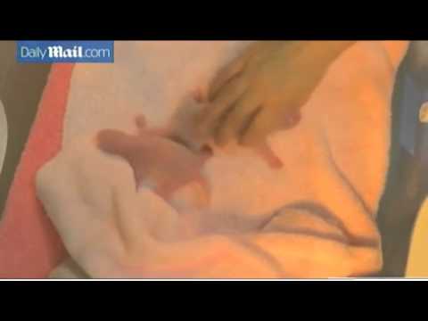 ولادة أول توأم لـ