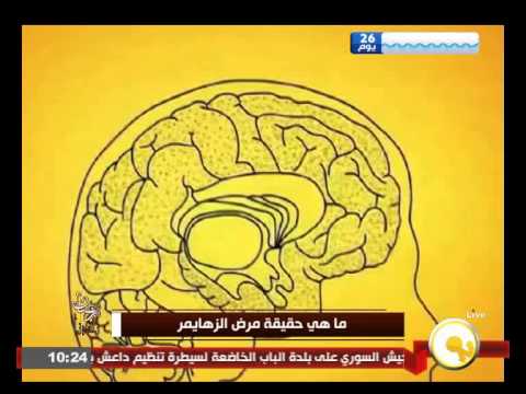 بالفيديو تعرف على حقيقة مرض الزهايمر