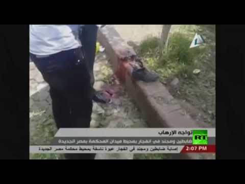 شاهد إصابة ضابطي شرطة ومجند