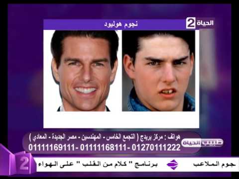 بعد استقالة المهندس إبراهيم محلب