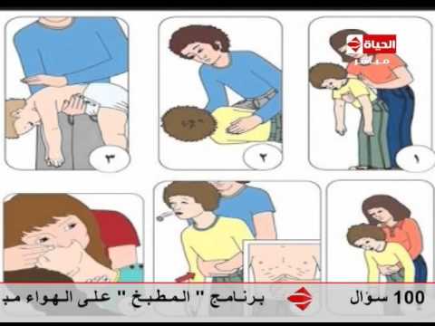 شاهد الإسعافات الأولية عند ابتلاعه جسم غريب