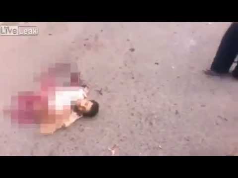 بالفيديو داعشي يتكلم ويتحرك بعد انشطاره لنصفين