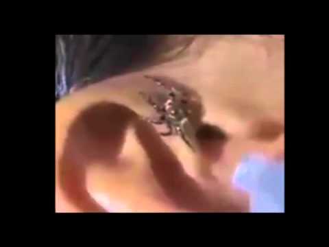 بالفيديو عنكبوت يدخل أذن رجل وهو نائم