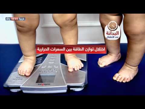 ارتفاع السكري والقلب والمفاصل بين الأطفال البدناء