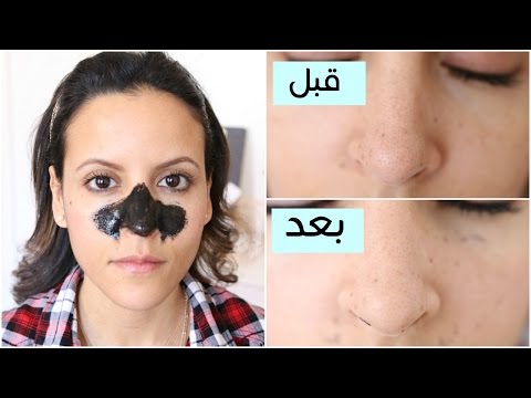 تخلصي من الرؤوس السوداء بأغرب الطرق الكورية الناجحة