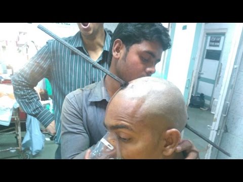 بالفيديو قضيب حديدي طوله مترين يخترق رأس رجل
