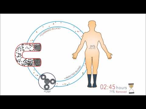 أحدث جهاز لعلاج الملاريا باستخدام فلتر مغناطيسي ينقي الدم