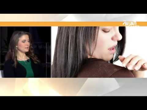 قشرة الرأس وأسبابها وسبل التخلص منها