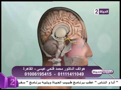 ورم الغدة النخامية وكيفية إستئصاله