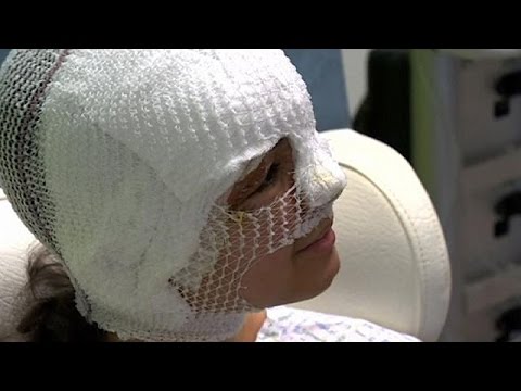 شابة فرنسية تحكي بعد إصابتها ما حدث في تفجير مطار بروكسل