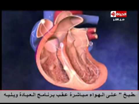 شاهد فيديو يوضح كيف تنتقل كهرباء القلب من الأذين للبطين