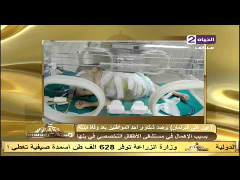 وفاة إبنة أحد المواطنين بعد عملية فصل توأم ملتصق