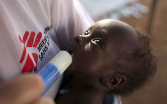   مصر اليوم - تفشي الكوليرا في جنوب السودان يهدد حياة 50 ألف طفل