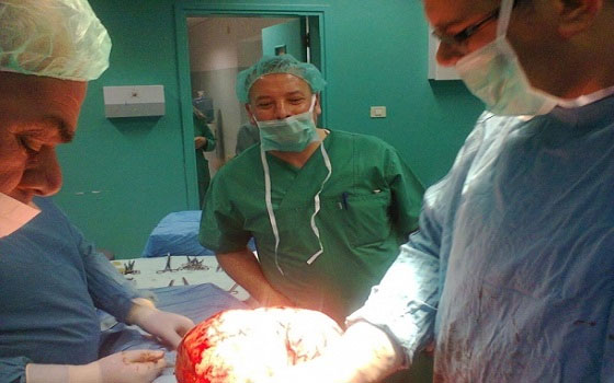   مصر اليوم - استئصال ورم سرطاني بحجم 6 كيلو من رحم مريضة في غزة