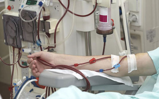   مصر اليوم - إیران تصنع الجیل الـ5 من جهاز الهیمودیالیز لغسيل الكلى