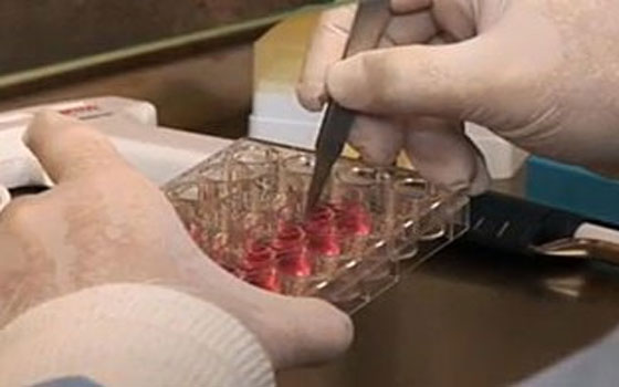   مصر اليوم - علماء ينجحون في استنساخ جنين قد يساعد في علاج مرض السُكري