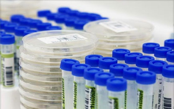   مصر اليوم - لقاح جديد ضد فيروس الإيبوالا يتم تجربته على الشامبانزي المحبوس