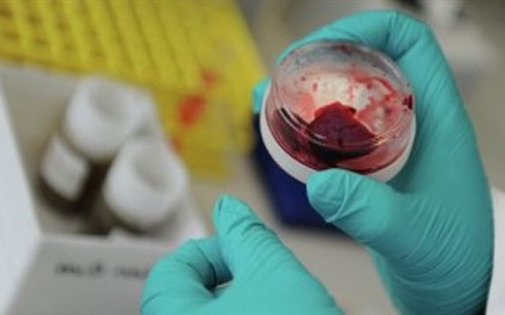   مصر اليوم - وزير الصحَّة السعودي يحدِّد مصدريْن للمرض الإبل المريضة وعدم الضبط في المستشفيات