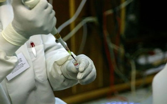   مصر اليوم - علماء ينجحون في تحديد الجين المسؤول عن تطوير الدهون السيئة بالجسم