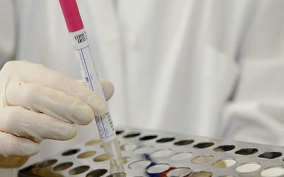   مصر اليوم - السعودية تعلن عن 4 حالات وفاة جديدة بفيروس كورونا